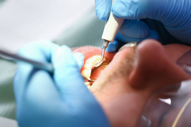Best Emergency Treatment for Toothache in Williamsburg, OH